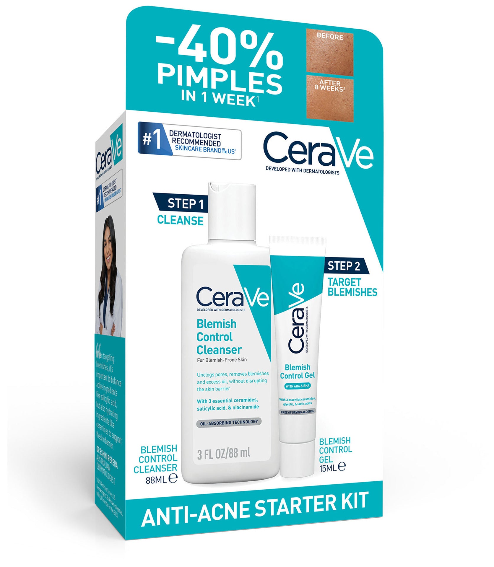 CeraVe Anti-Acne Starter Kit